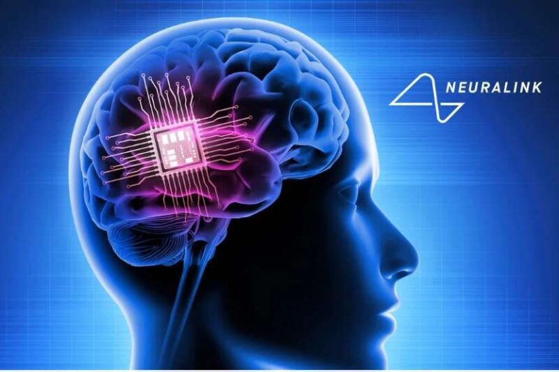 Neuralink Patok Tanam Chip Bagi 1.000 Pasien